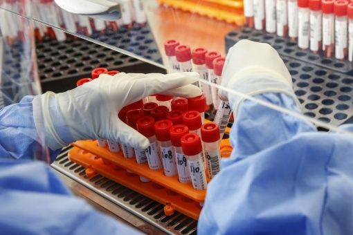 Rusia anunció que la próxima semana iniciará pruebas clínicas con la vacuna en más de 40.000 personas en 45 centros médicos.